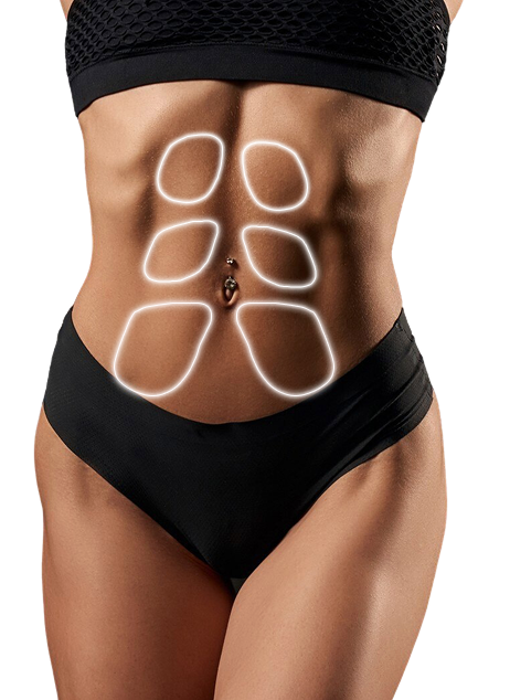 Абдоминопластика — результат